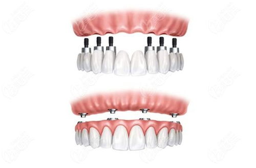 茅台医院补牙多少钱,牙科茅台 茅台医院补牙多少钱,牙科茅台